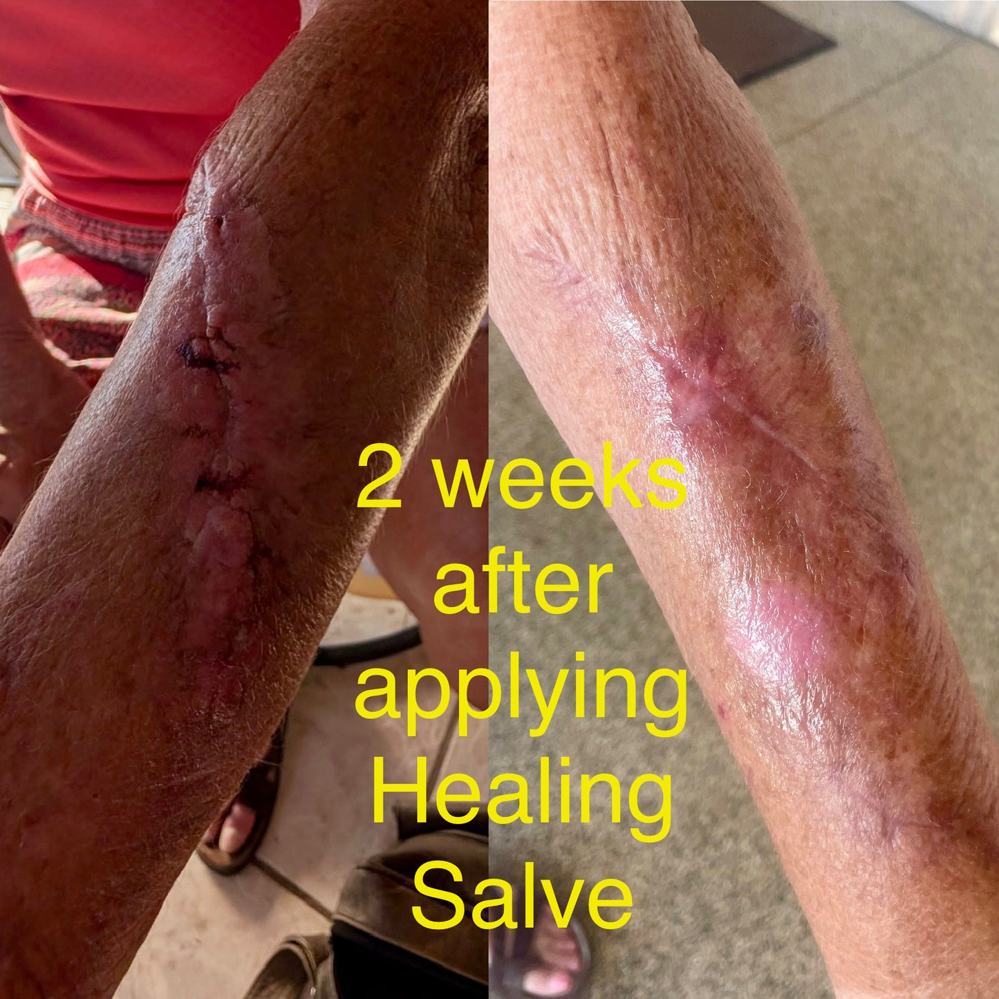 Tallow Healing Salve