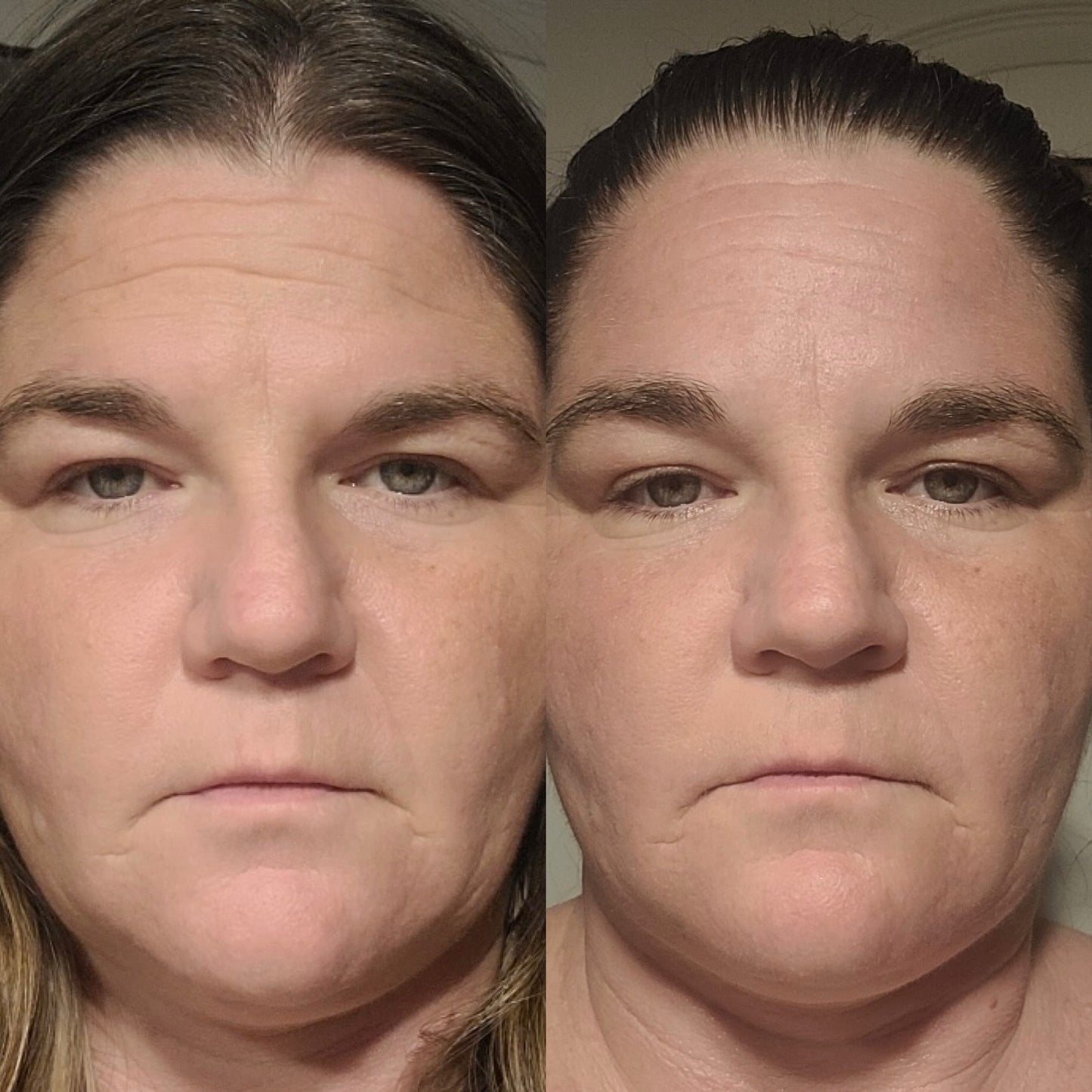 Less wrinkles, less inflammation, reduce dark spots, Natural skincare, helps acne, helps eczema, help psoriasis, helps wrinkles, hydrates skin, organic skincare
Natural skincare, skin hydration, helps acne, reduces wrinkles, reduces fine lines, organic skincare, Beef Tallow Skincare, wound care, rash care, helps eczema, helps psoriasis, helps rosacea