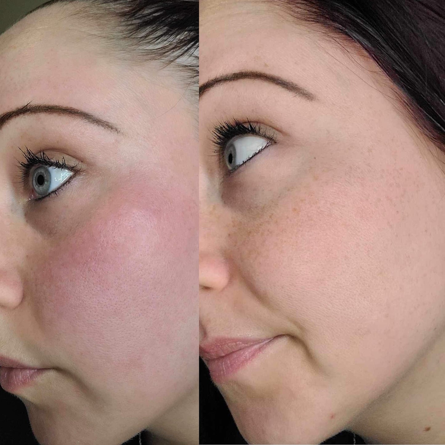 Less inflammation, less wrinkles, Natural skincare, helps acne, helps eczema, help psoriasis, helps wrinkles, hydrates skin, organic skincare
Natural skincare, skin hydration, helps acne, reduces wrinkles, reduces fine lines, organic skincare, Beef Tallow Skincare, wound care, rash care, helps eczema, helps psoriasis, helps rosacea